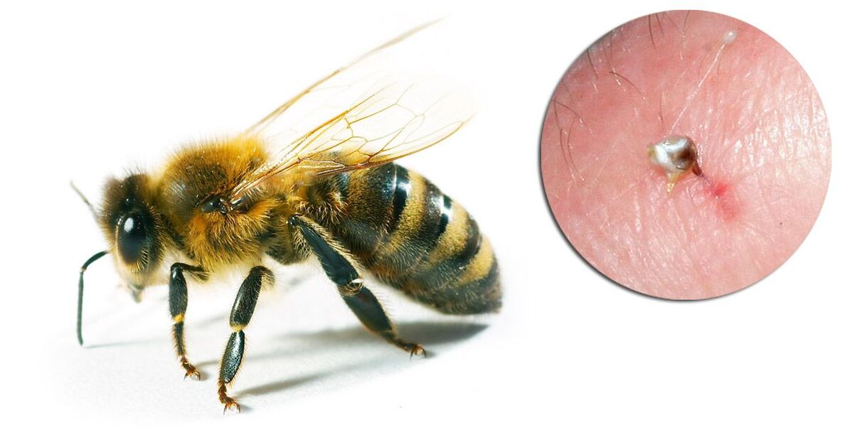 Το Hondrostrong περιέχει δηλητήριο μελισσών, το οποίο βελτιώνει τις μεταβολικές διεργασίες στους ιστούς